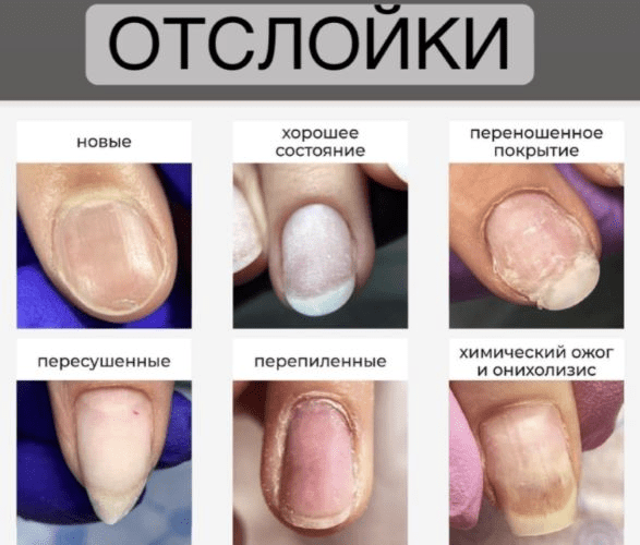 [Вельмитина Зайцева] Отслойки (2021)