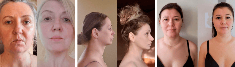 [Елена Гондорчин] Лекторий. Платформа для практик. Модуль 2. Восстановление лица (2025)