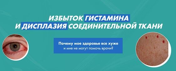 [Дарья Ермишина] Избыток гистамина и дисплазия соединительной ткани (2025)