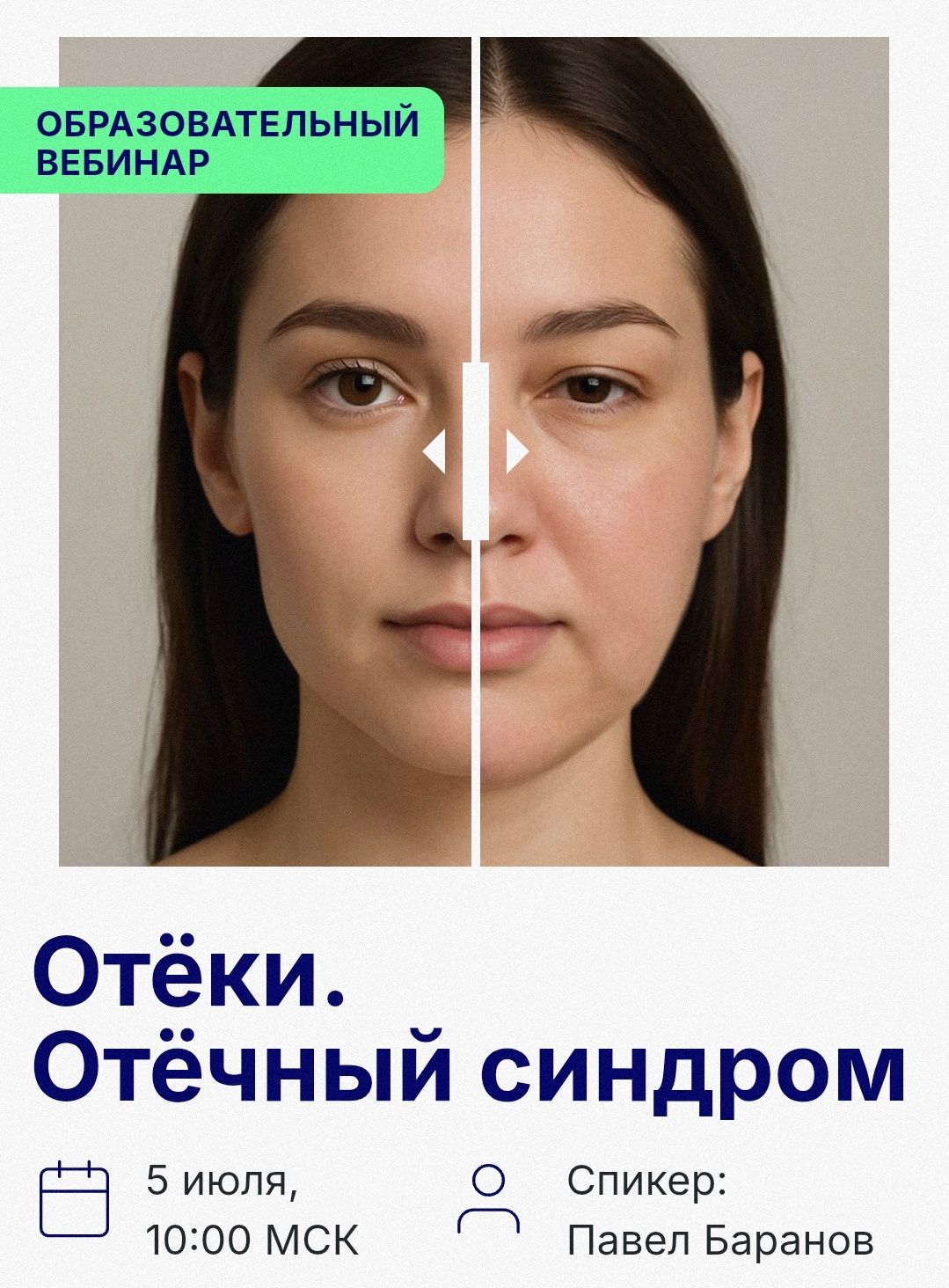 Отеки [Павел Баранов]