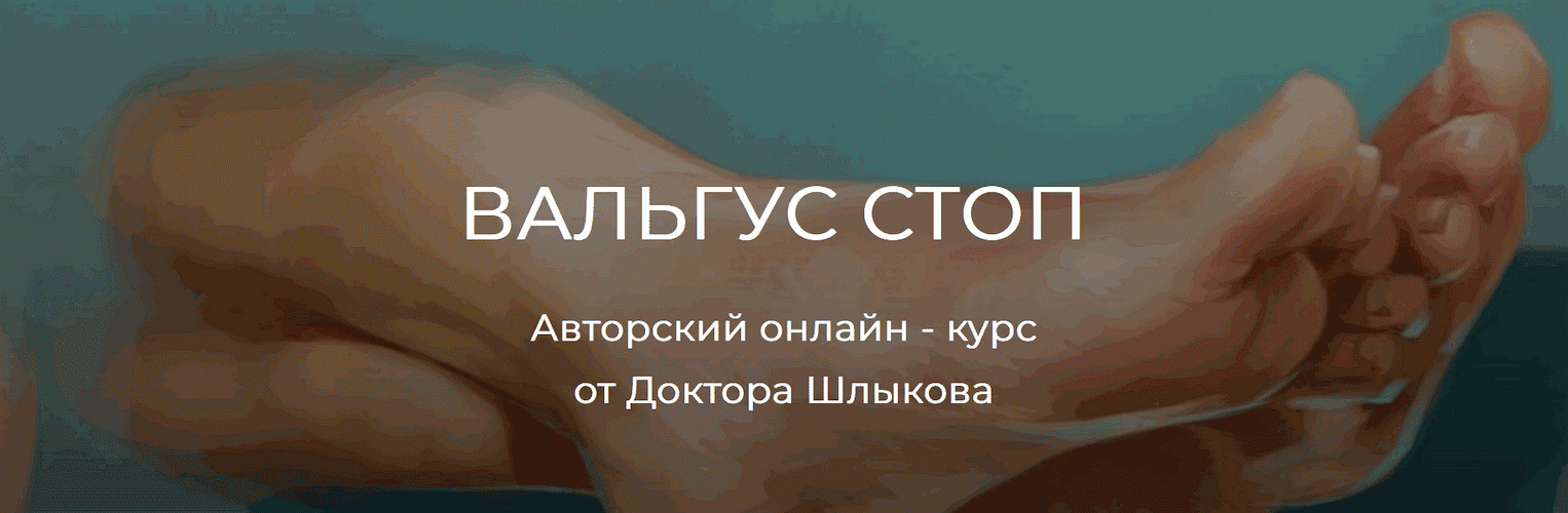 Вальгус стоп [Кирилл Шлыков]