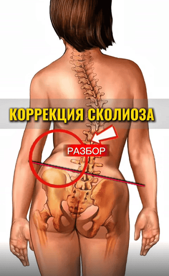 Сколиоз-off [Тариф Base] [Алина Путова]