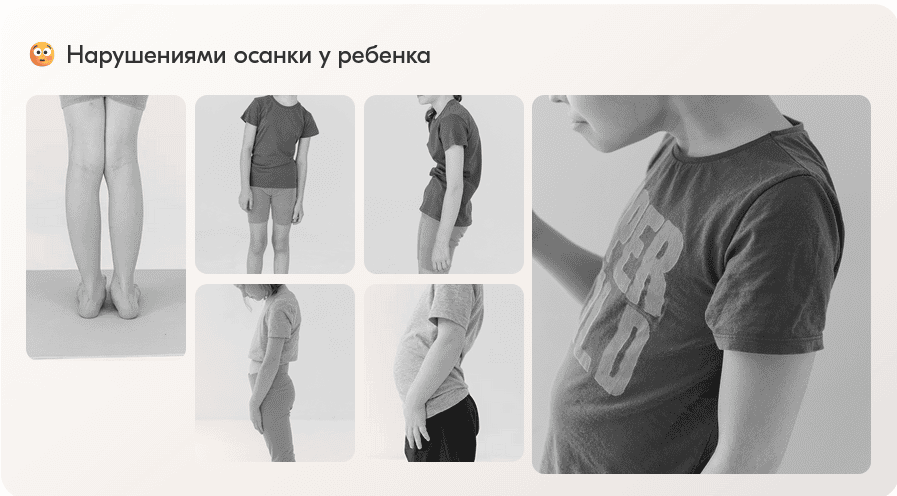 Здоровая осанка и стопы. Клуб [Е. Зарываева, А. Ольховская, Е.Лепехина и д.р.]