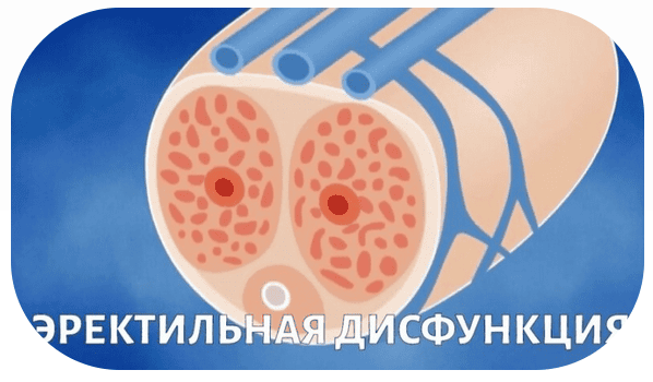 Нарушения половой функции у мужчин. Эректильная дисфункция и её составляющие - ... [Pro et Contra] [Юлия Тишова, Роман Роживанов]