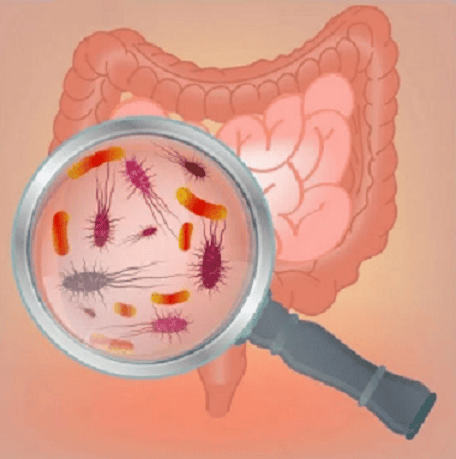 Как восстановить микрофлору кишечника через питание и пищевые привычки [Александра Бонина]