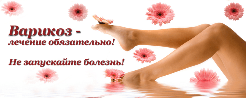 Варикозное расширение вен. Геморрой. - Жгарёва