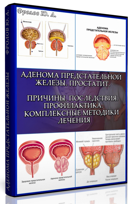 Мини инфопродукт №4 «Аденома предстательной железы. Простатит. Причины. Последствия. Профилактика